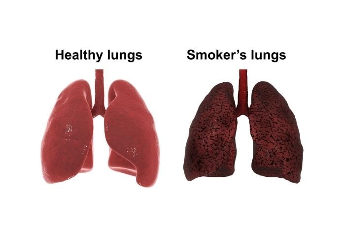 吸食電子菸 同樣也可能導致肺炎