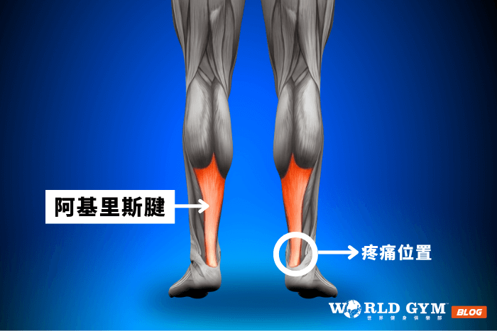 阿基里斯腱位置