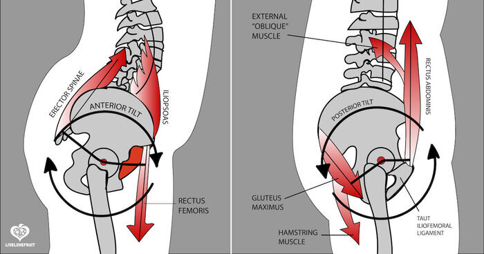 causes-of-posterior-pelvic-tilt