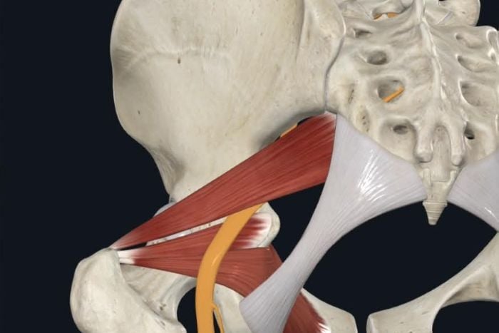 piriformis-syndrome-2-1