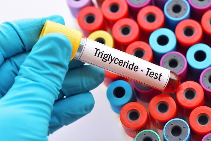 triglyceride-test