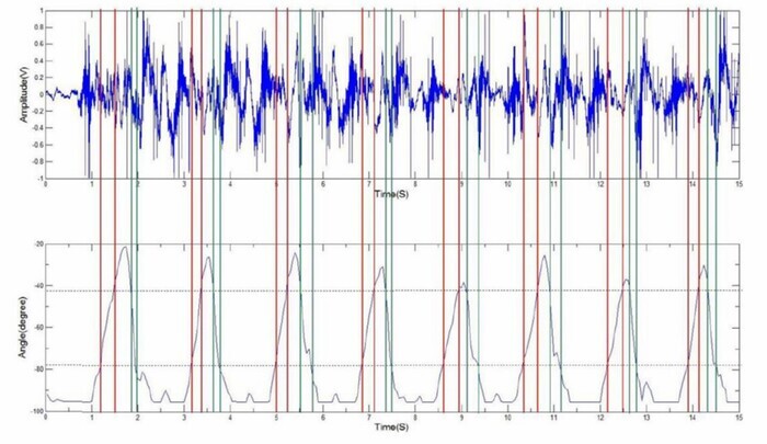 vibroarthrography-VAG