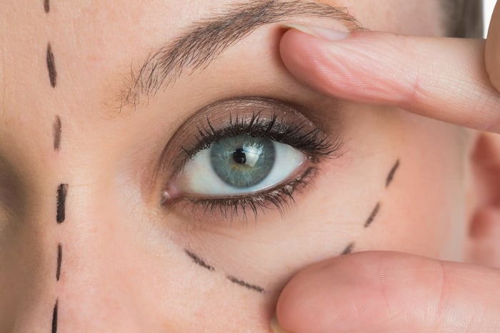 擺脫黑眼圈的方法 眼瞼手術治療 家庭療法